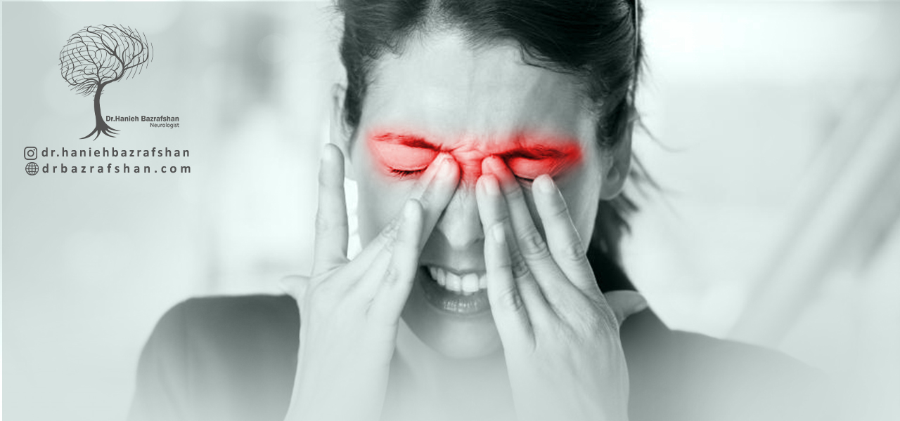 علائم میگرن چشمی