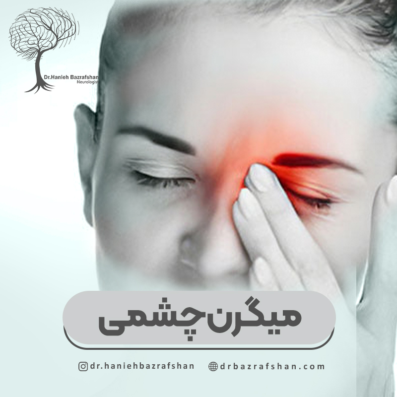 میگرن چشمی چیست و چگونه درمان میشود؟