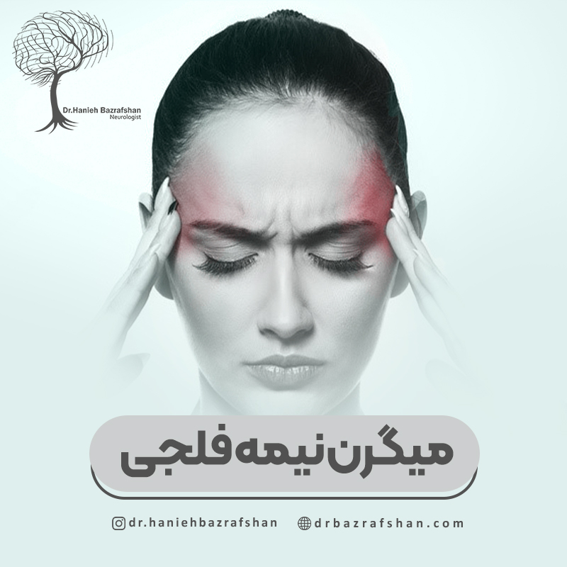 میگرن همی پلژیک یا میگرن نیمه فلجی