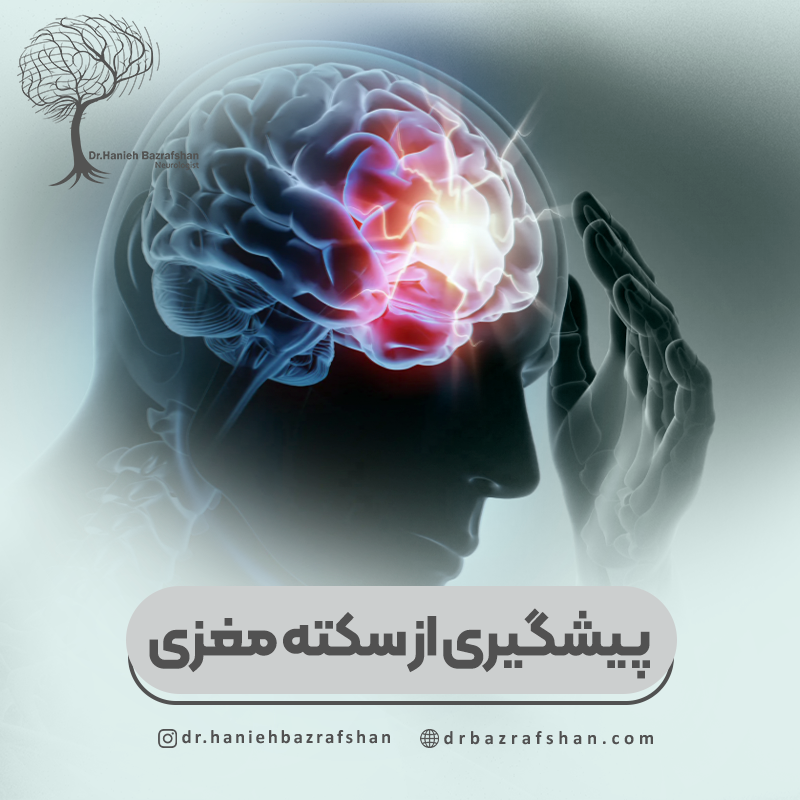 راه های مهم از پیشگیری سکته مغزی